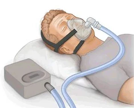 ventilator