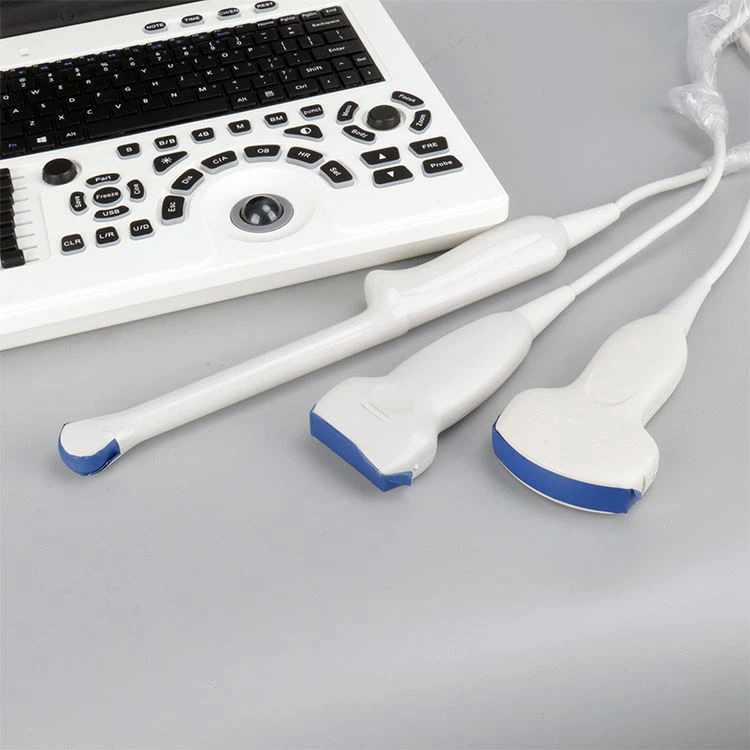 portable ultrasound 3