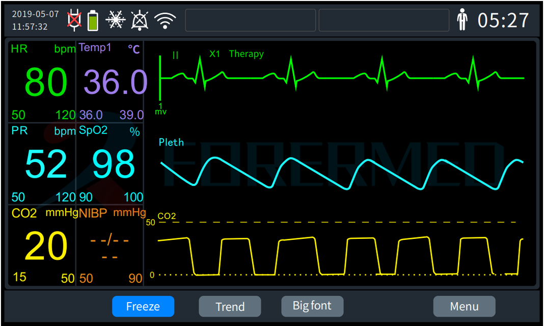 defibrillator charge defibrillator charge