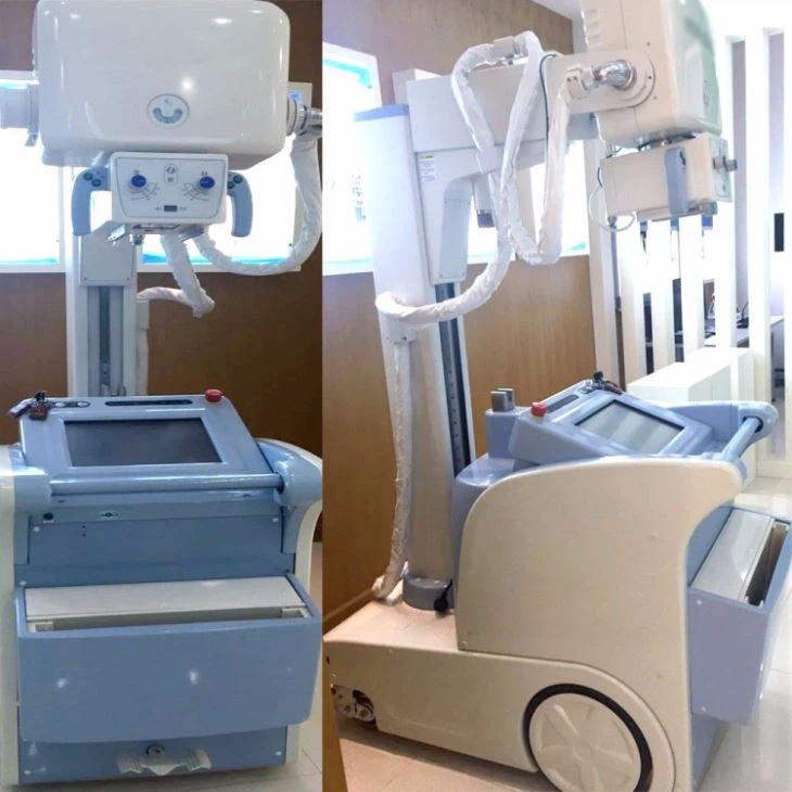 Portable Digital X-Ray System