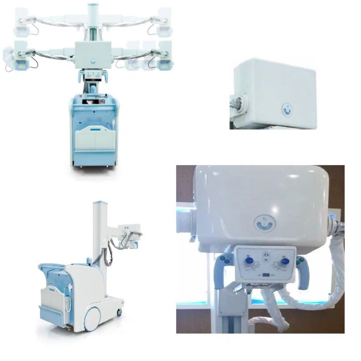 Portable Digital X-Ray System