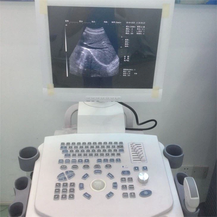 2D B/W Trolley Ultrasound System Scanner