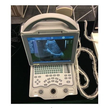 Human Ultrasound Scanner Human Ultrasound Scanner