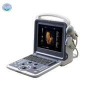YJ-U60PLUS Color Doppler —— نظام تشخيص بالموجات فوق الصوتية دوبلر ملون رقمي كامل