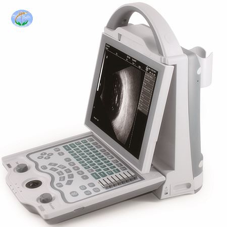 Ophthalmic Ultrasound A/B Scanner Ophthalmic Ultrasound A/B Scanner