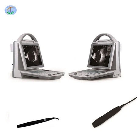 Ophthalmic Ultrasound A/B Scanner Ophthalmic Ultrasound A/B Scanner