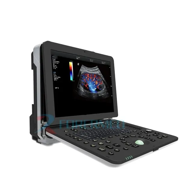 الموجات فوق الصوتية للقلب