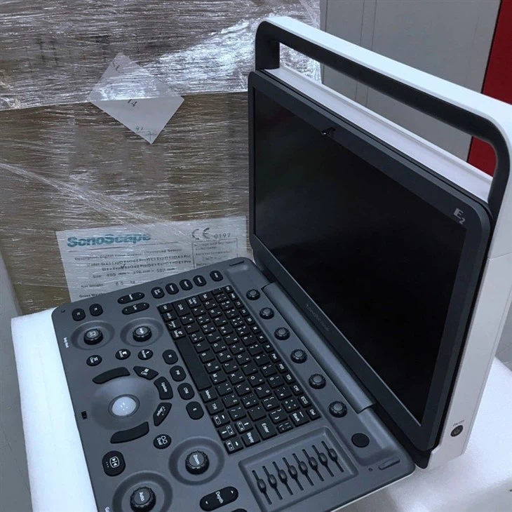 sonoscape ultrasound